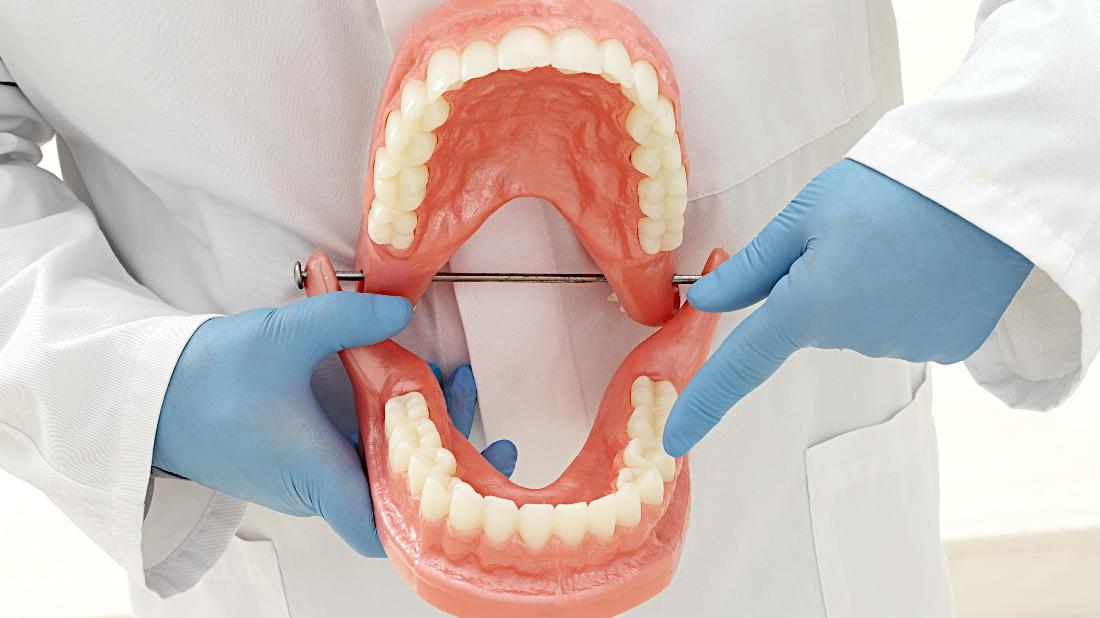 Dental Benefit Terminology Dentist in Gretna LA Insurance