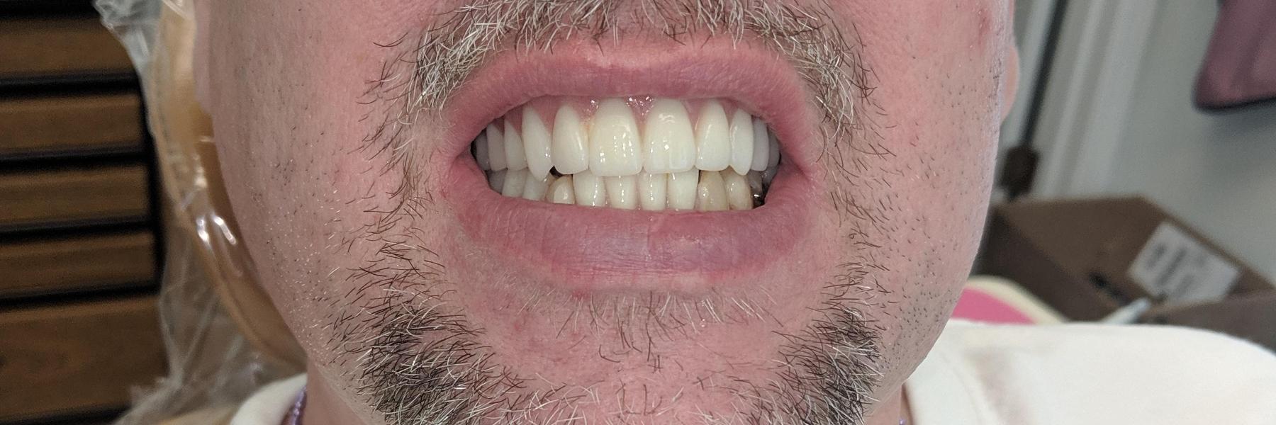 Teeth Cleanings & Exams | Dentist